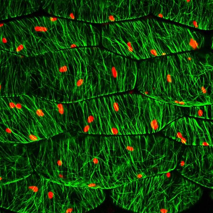 Confocal micrograph of a leaf. Microtubules shown in green and Chloroplasts shown in red.